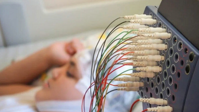 Tıp tarihinde bir ilk! Epilepsi hastası çocuk kafasına yerleştirilen cihazla iyileşti Tıp dünyasından heyecan verici bir haber var sırada. İngiltere'de 13