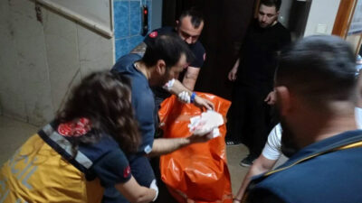 İşhanında feci kaza: Parmakları ve bacağını makineye kaptırdı