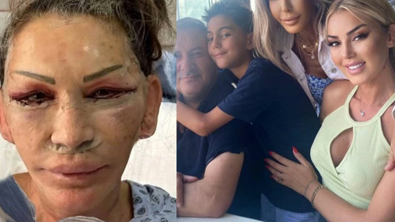 Ünlü ismin annesi şoke etti! ”Eski halimi unuttum” Ünlü şarkıcı Petek Dinçöz'ün annesi Esra Süay Toğuş bir süre