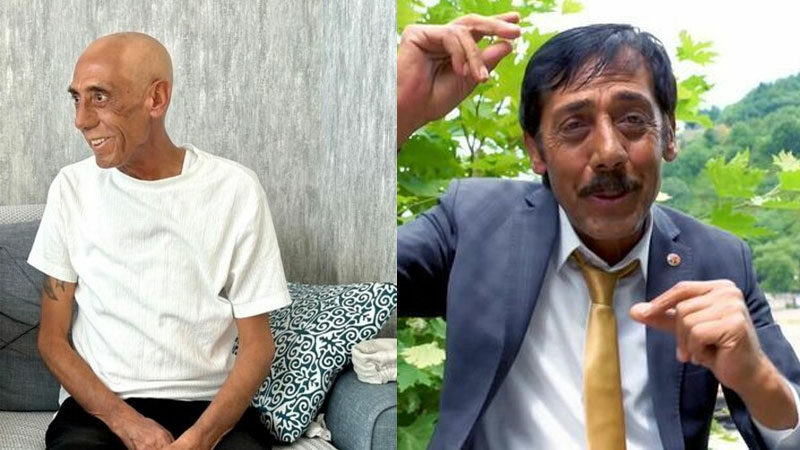 Ankaralı Turgut’un son durumuyla ilgili kızından açıklama Akciğer kanseriyle mücadele eden Ankaralı Turgut, birkaç gün önce entübe