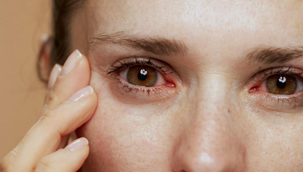 Dünya yeni salgın için alarmda! Seyahat uyarıları devrede… Dünya yeni salgın için alarmda! Seyahat uyarıları devrede…