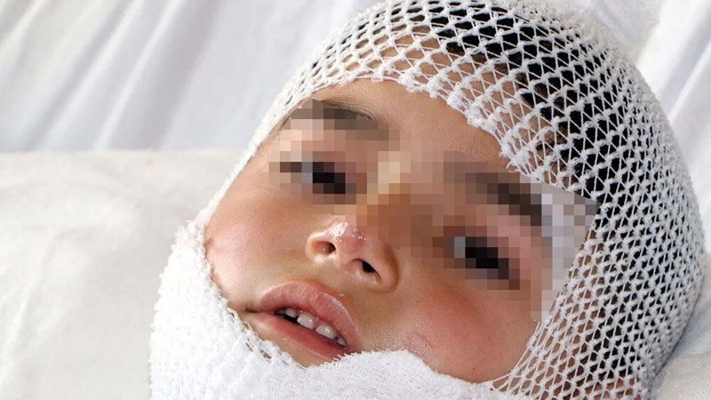 Pilav kazanına düşen Ferid’in yaşam savaşı Pilav kazanına düşen Ferid’in yaşam savaşı