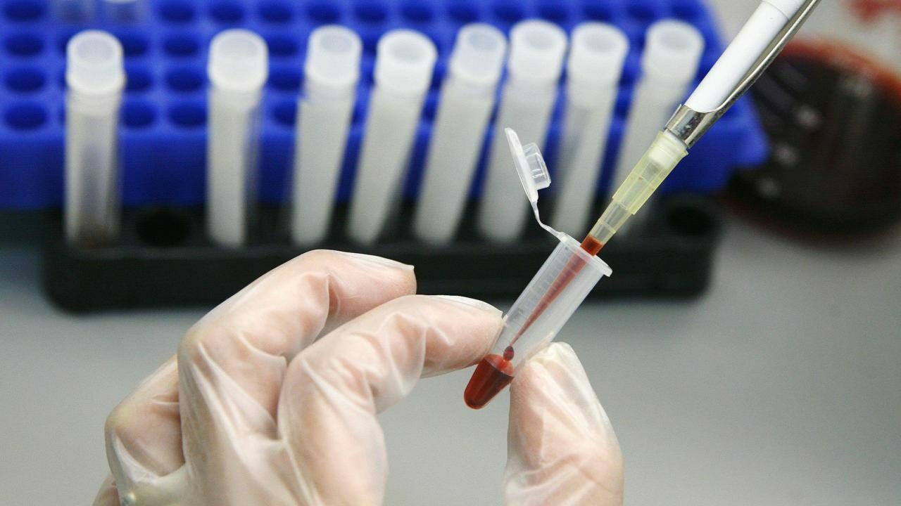 HIV olduğunu eşinden saklayan kocanın 20 yıl hapsi istendi HIV olduğunu eşinden saklayan kocanın 20 yıl hapsi istendi