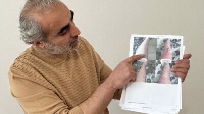 Sedef, egzama, uyuz ve vitiligo hastalıkların çözümü…