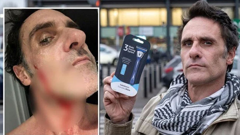 Tıraş bıçağıyla yüzünü kesti: 211 bin lira kazandı Tıraş bıçağıyla yüzünü kesti: 211 bin lira kazandı