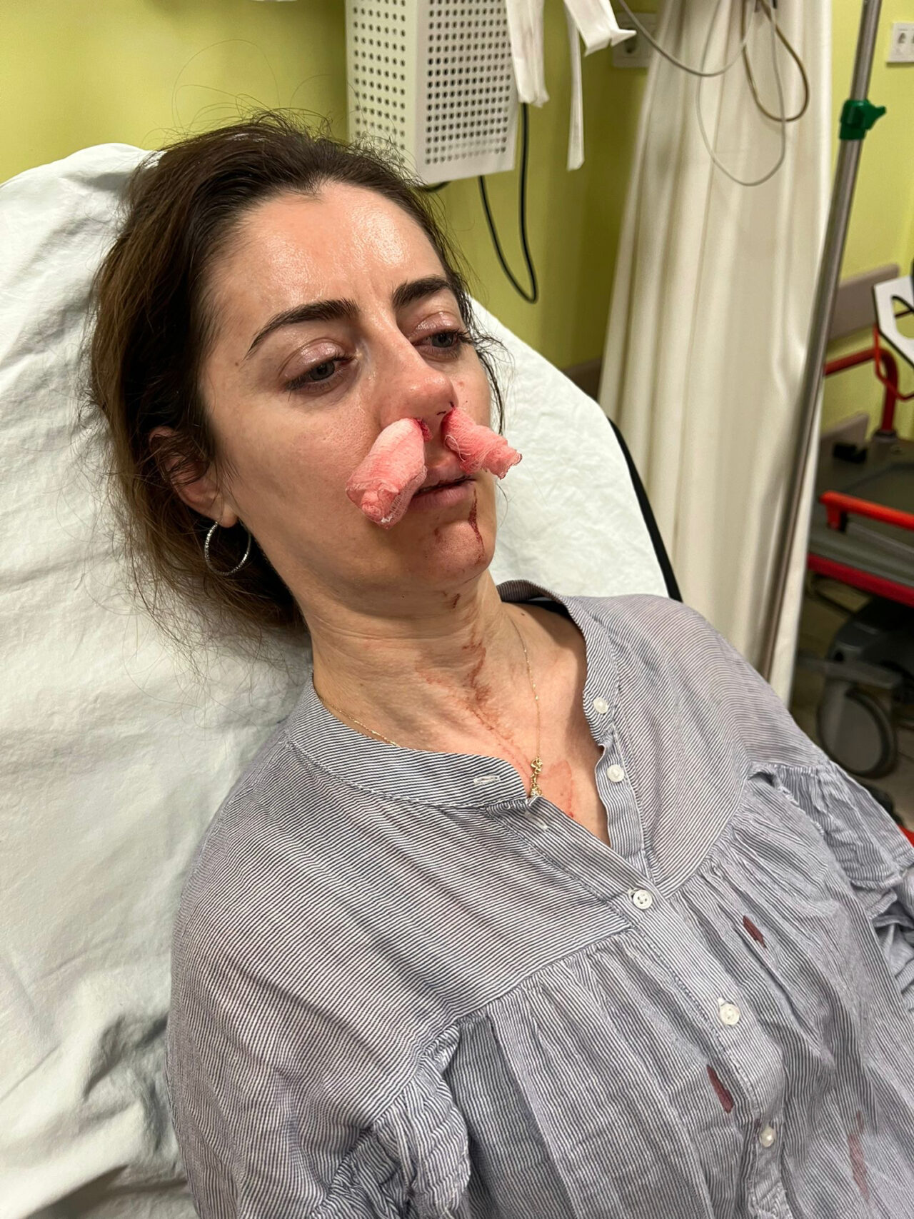 Akılalmaz olay! Kocasının sevgilisine benzetip hastanelik etti sonra da özür diledi Akılalmaz olay! Kocasının sevgilisine benzetip hastanelik etti sonra da özür diledi