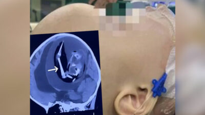 Doktorları şaşkına çeviren röntgen görüntüsü! İçindekini görünce şoke oldular