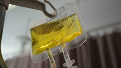 Sağlık Bakanlığı’ndan ‘sarı serum’ açıklaması