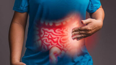 Kolon kanserine karşı önemli uyarı: 50 yaşından sonra mutlaka yaptırın!