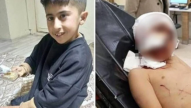 Sokak köpekleri saldırdı! Murat yoğun bakımda