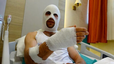 Nişanlısına hediye paketi hazırlarken hastanelik oldu