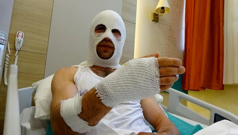 Nişanlısına hediye paketi hazırlarken hastanelik oldu