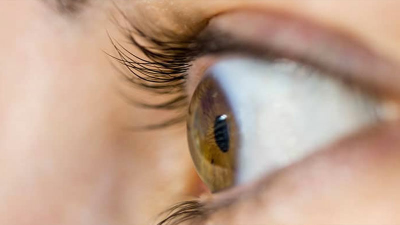 Göz problemi yaşayanların gözlük numaralarının sık sık artması, bu artışa