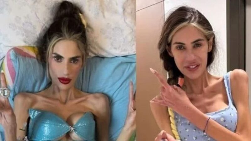 Nihal Candan hayatını kaybetti Anoreksiya nervoza rahatsızlığı nedeniyle 25 kilonun altına düşen sosyal medya