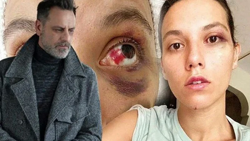 Ozan Güven’e hapis cezası Birliktelikleri şiddet iddiasıyla biten Deniz Bulutsuz ve Ozan Güven'in birbirlerinden