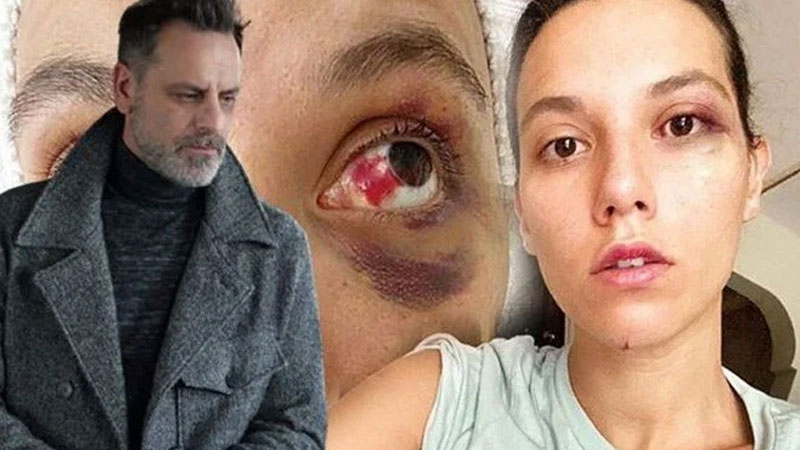 Ozan Güven’e hapis cezası