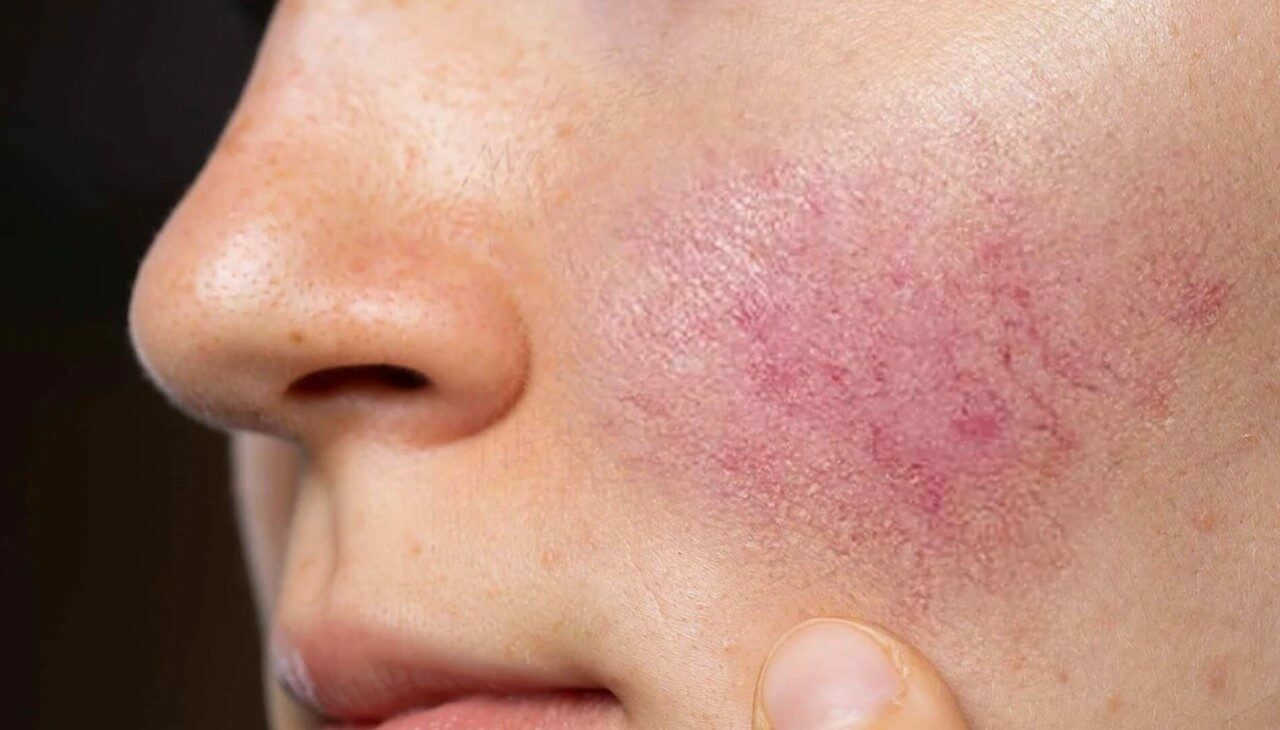 Uzman isim uyardı: İhmal etmeyin