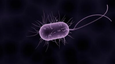 ABD'de “et yiyen bakteri” olarak bilinen Vibrio vulnificus nedeniyle bu