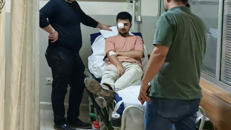 Bursa’da fabrikada feci kaza Bursa’nın İnegöl ilçesinde, kumaşı çivi tabancasıyla tutuşturduğu sırada ahşaptan fırlayan