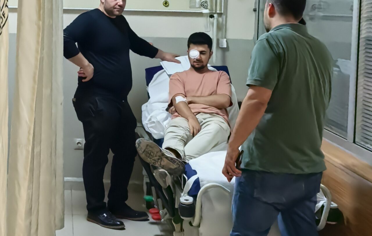 Bursa’da fabrikada feci kaza