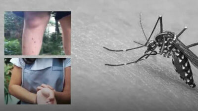 Sivrisinekle bulaşan virüse dikkat! Her 10 kişiden biri ölüyor