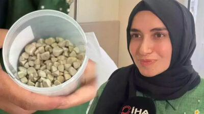 Doktorlar bile şok oldu! Hepsi vücudundan çıktı