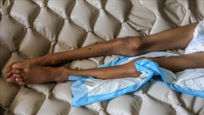 Gazze’de dram sürüyor! 6 kişi daha açlıktan öldü