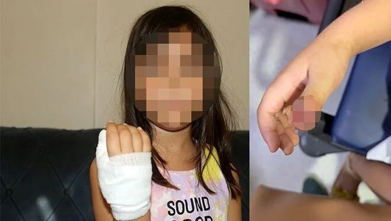 Anaokulunda korkunç olay