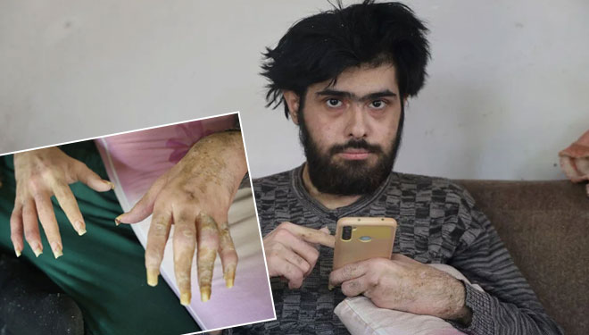 Depremden sonra dışarıya hiç çıkmadı!