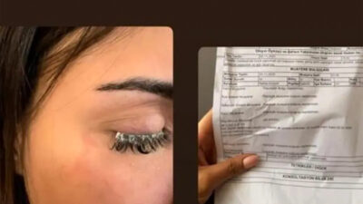 Kirpiklerini yaptırmaya gitmişti! Hayatı ‘karardı’