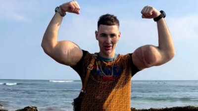 “Rus Temel Reis” kollarını kaybetmek üzere