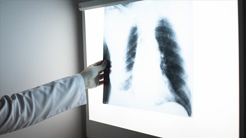 Burtom Konur Cerrahi Tıp Merkezi Göğüs Hastalıkları Uzmanı Dr. Güler