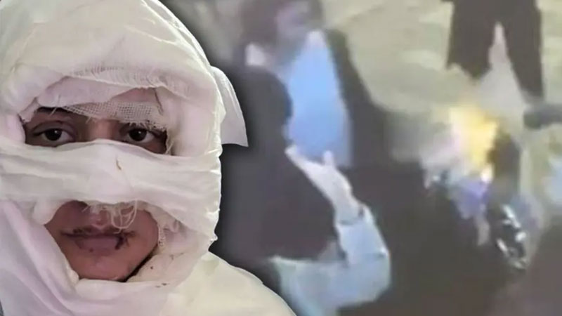 Kadıköy’de genç kadını kolonya döküp yaktı, istenen ceza belli oldu Kadıköy’de genç kadını kolonya döküp yaktı, istenen ceza belli oldu