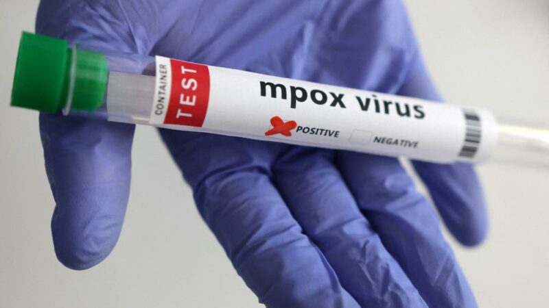 Maymun çiçeği virüsünün yeni bir türü tespit edildi Bilim insanları, İngiltere’de yeni bir mpox varyantının tespit edildiğini açıkladı.