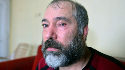 Çay bardaklı dehşet! Gözünü kaybetti