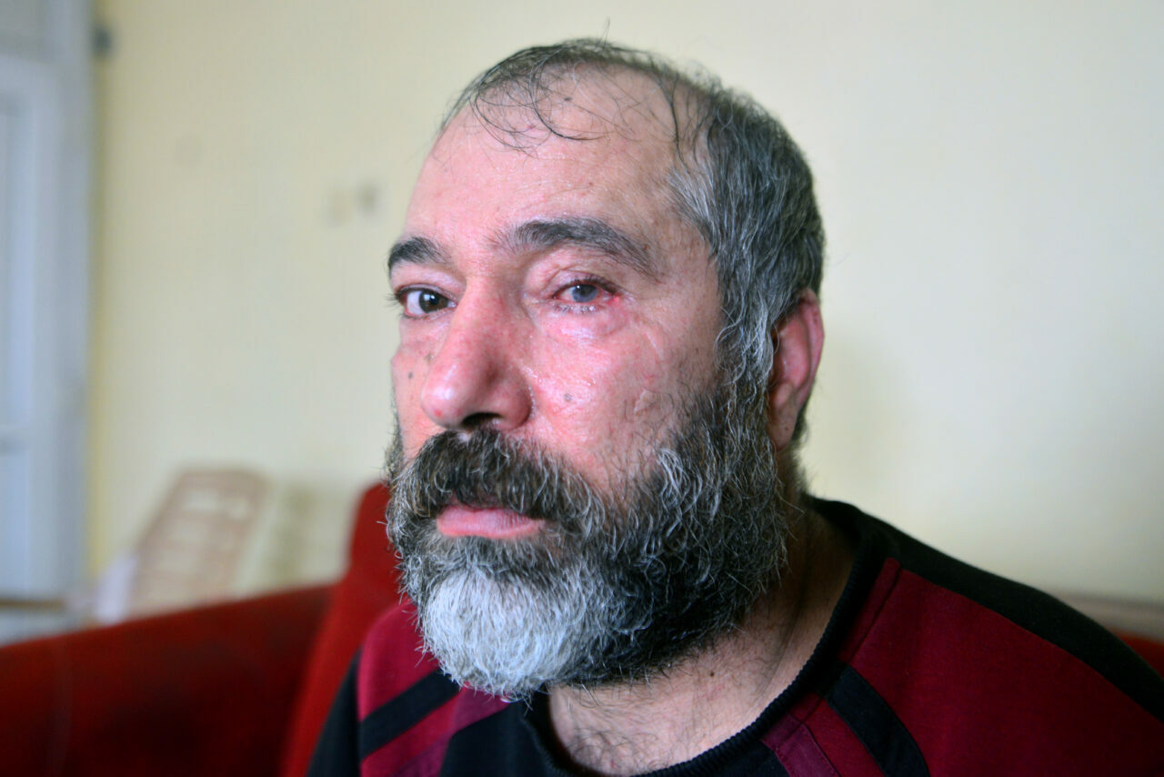 Çay bardaklı dehşet! Gözünü kaybetti Çay bardaklı dehşet! Gözünü kaybetti