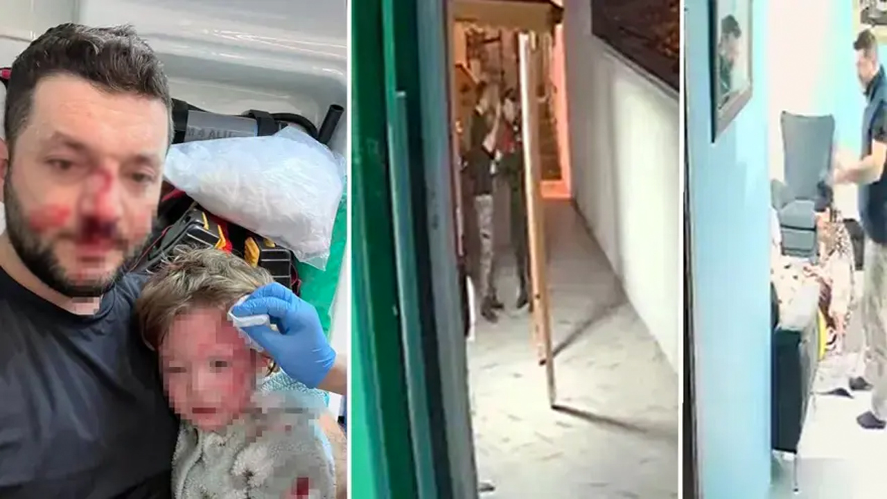 Yalova’da 14 aylık bebeği saldırı! İşte istenen ceza Yalova’da 14 aylık bebeği saldırı! İşte istenen ceza