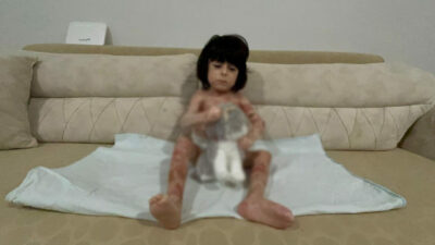 Bursa’da yürek yakan dram! Küçük İbrahim yardım bekliyor