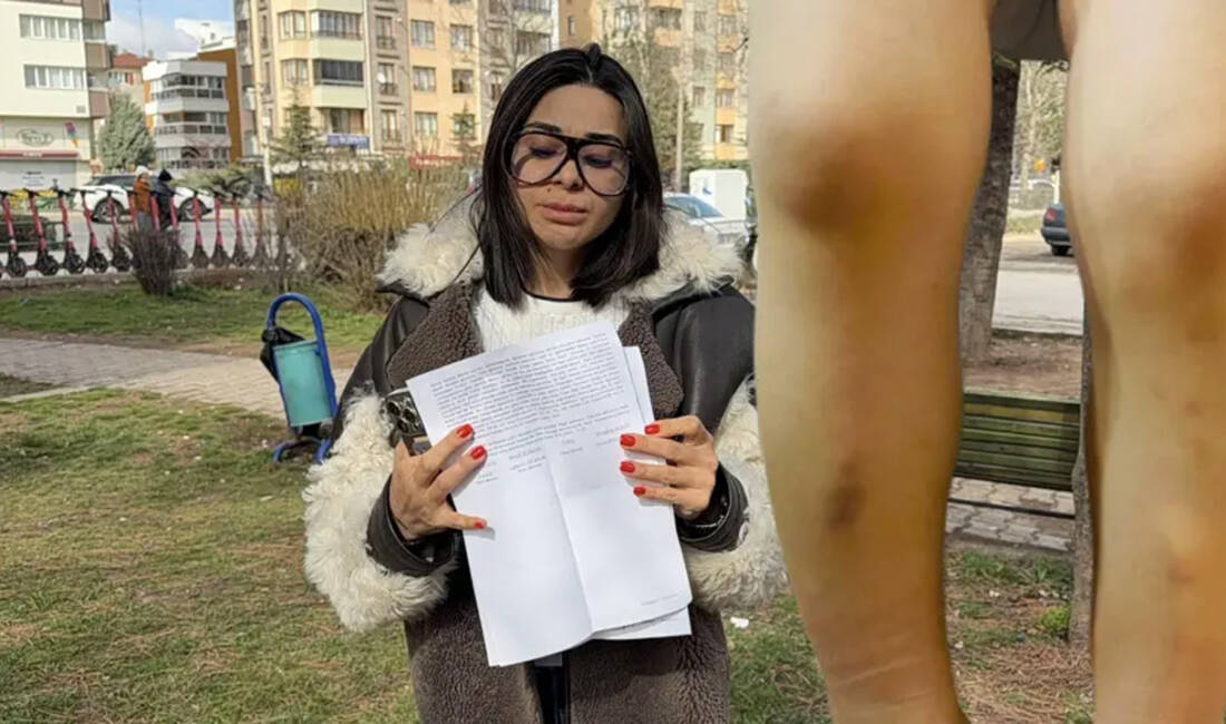 Kreşte dayak iddiası! Eskişehir’de Emine Pınar Özdağ (38), oğlu Atlas’ın (2) öğrenim gördüğü