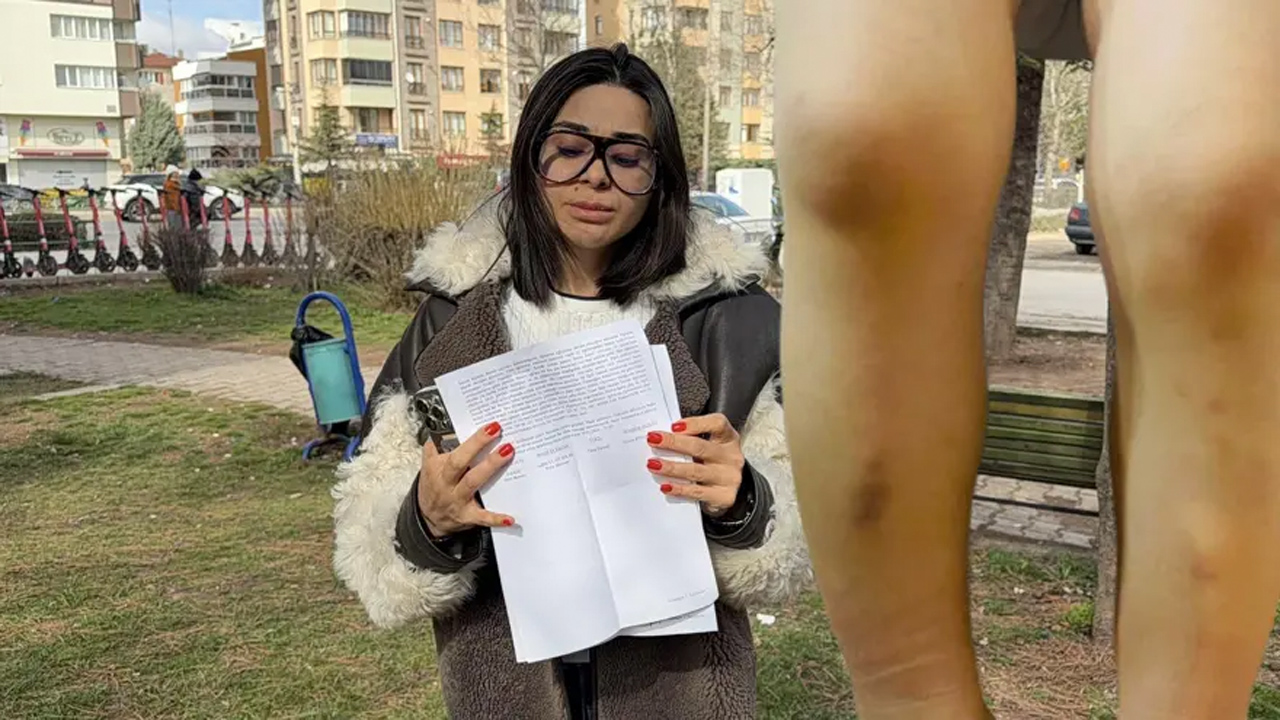 Kreşte dayak iddiası! 7 eskisehir kres dha