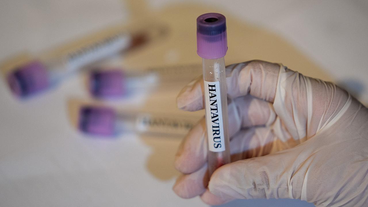 DSÖ'den hantavirüs açıklaması 1 dsoden hantavirus aciklamasi 3bd189dfce8c