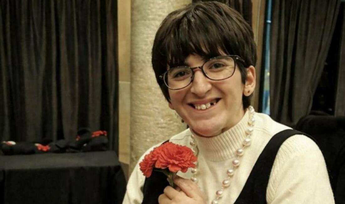 Bursa’da 3 kişiye hayat veren bağış Bursa'da doğumundan itibaren nadir görülen Rubistein-Taybi Sendromu ile mücadele eden