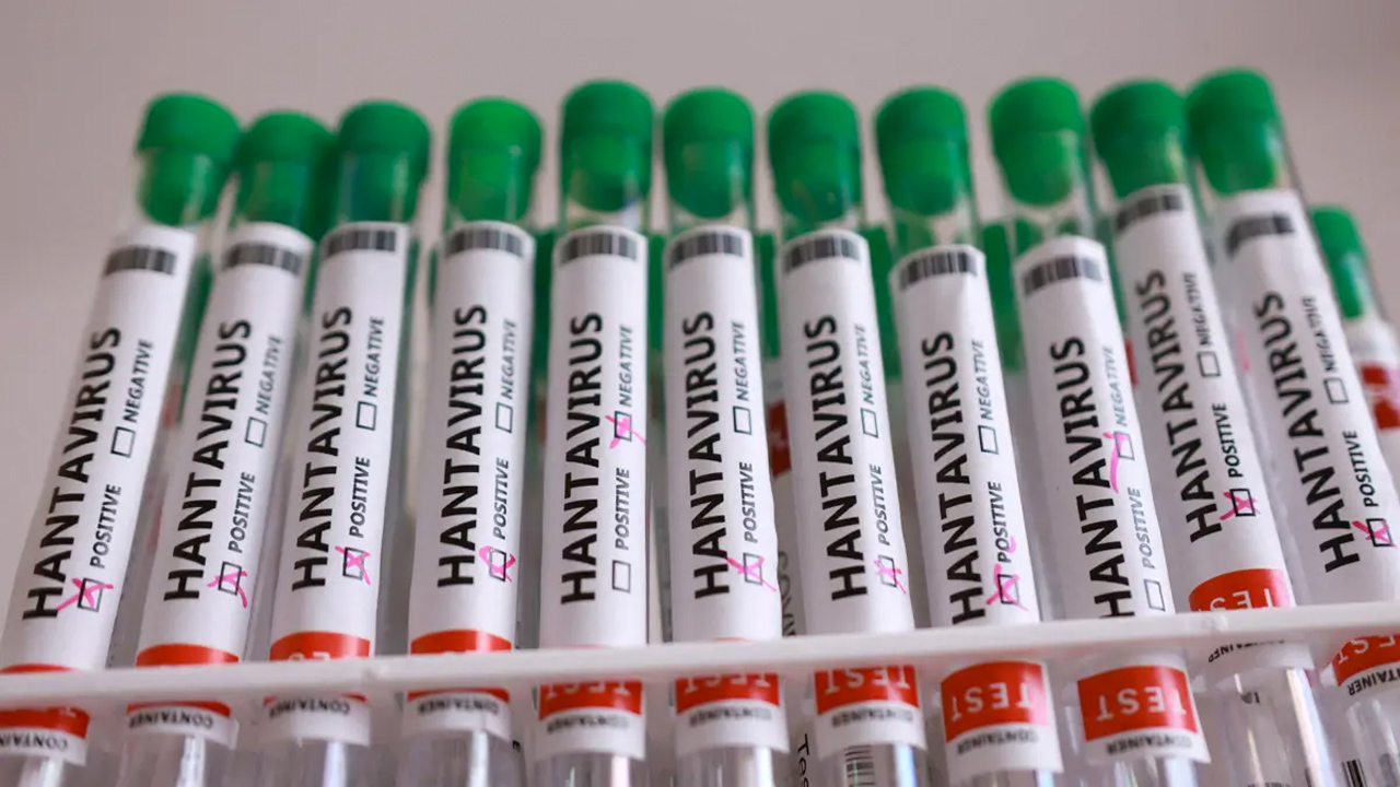 Bir ülkede daha hantavirüs alarmı 1 hantavirus reu