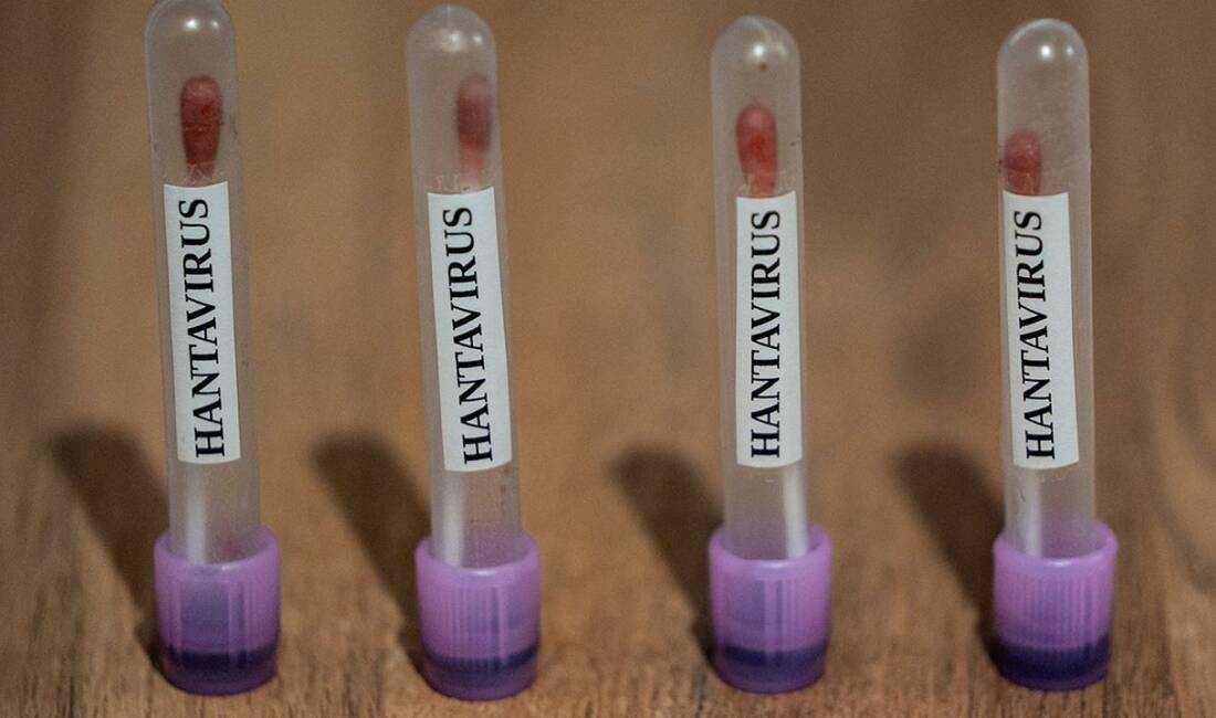 ABD Hastalık Kontrol ve Önleme Merkezlerinin (CDC), hantavirüs vakalarını "3.