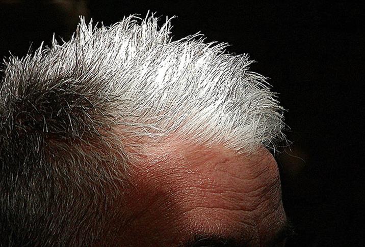 Biruni Üniversitesi Tıp Fakültesi Hastanesi Genetik Hastalıklar Tanı ve Değerlendirme