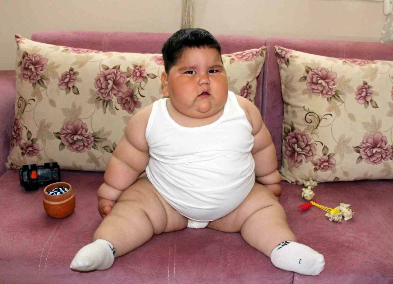 5 yaşında 90 kiloya çıkmıştı! Yağız'ın inanılmaz değişimi şaşırttı 2 5 yasinda 90 kiloya cikmisti yagizin son hali sasirtti c58d2ce347aa