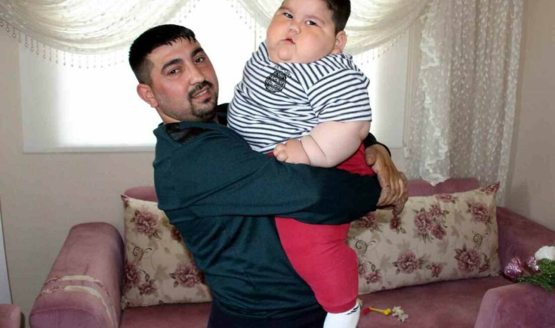 5 yaşında 90 kiloya çıkmıştı! Yağız’ın inanılmaz değişimi şaşırttı Samsun’da doğuştan leptin hormonu eksikliği nedeniyle tokluk hissi oluşmayan ve