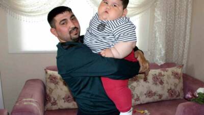 Samsun’da doğuştan leptin hormonu eksikliği nedeniyle tokluk hissi oluşmayan ve