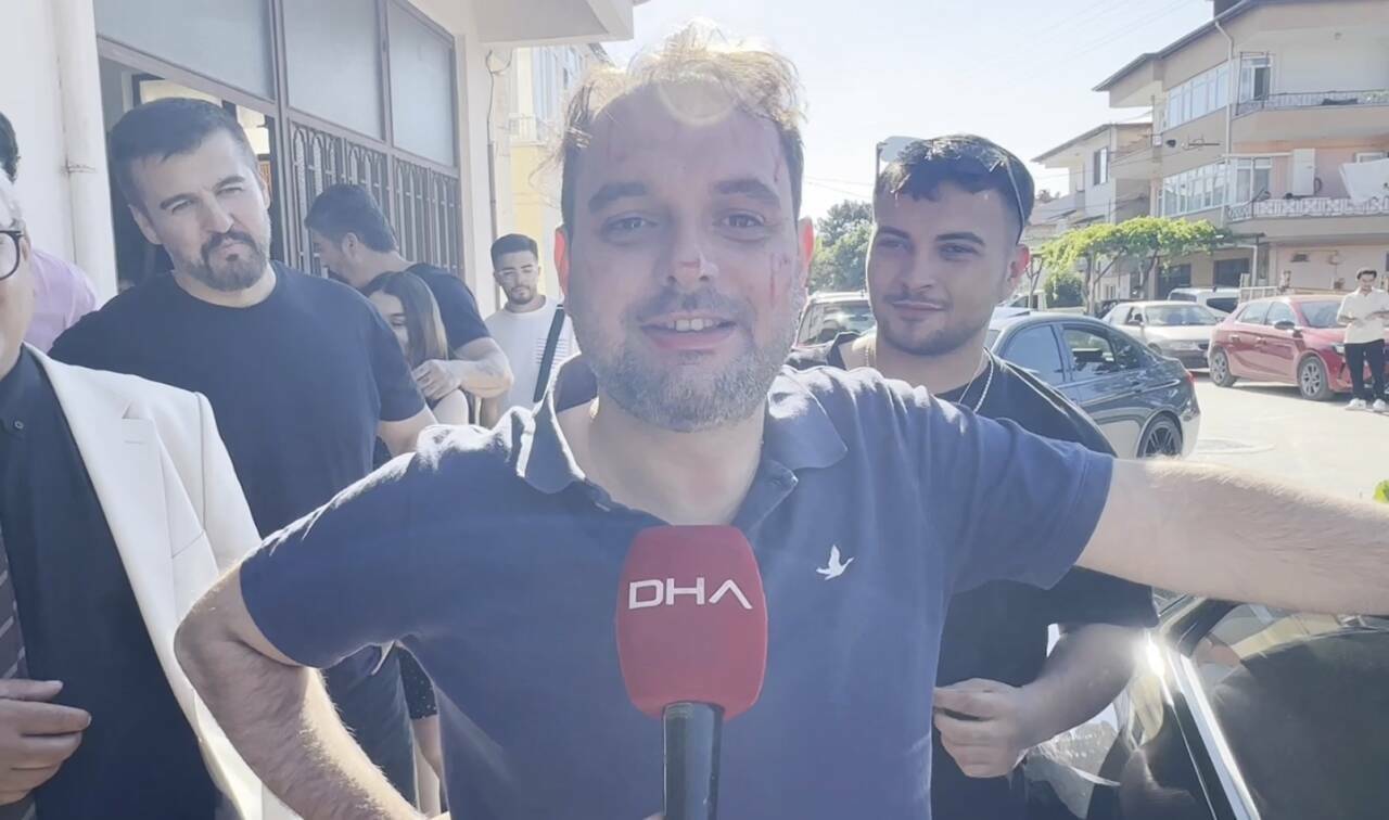 bursada damada iskence gibi eglence neler yapmadilar ki e661772d8bf1