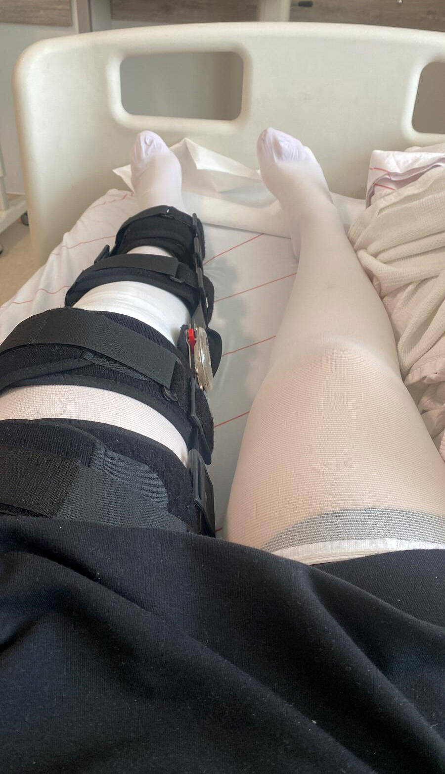 Özel hastanedeki doktordan akıl almaz hata 2 doktordan skandal hata sakatlanani degil saglam olani ameliyat etti 2d1bb4a13740